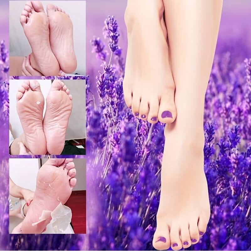 Exfoliating Peeling Socks - Foot Mask - Image 4